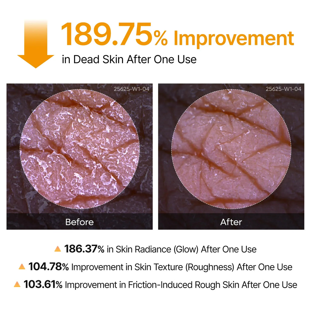 Peel Shot Keratin Care Kojic Acid Turmeric Spray